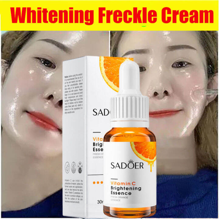 Vitamin C Serum Melasma and Pekas Remover Dark Spots Whitening