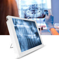 LED Viewbox ฟิล์ม Illuminator กล่องไฟแผง LED Flat Panel ทันตกรรมฟิล์ม Viewer Light Pad สำหรับ Home Dental