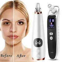 Blackhead Acne Remover Vacuum Cleaner Grease Face Skin Care Extractor Pore Nose Lift Suction Facial Removal Needle Tool Massager