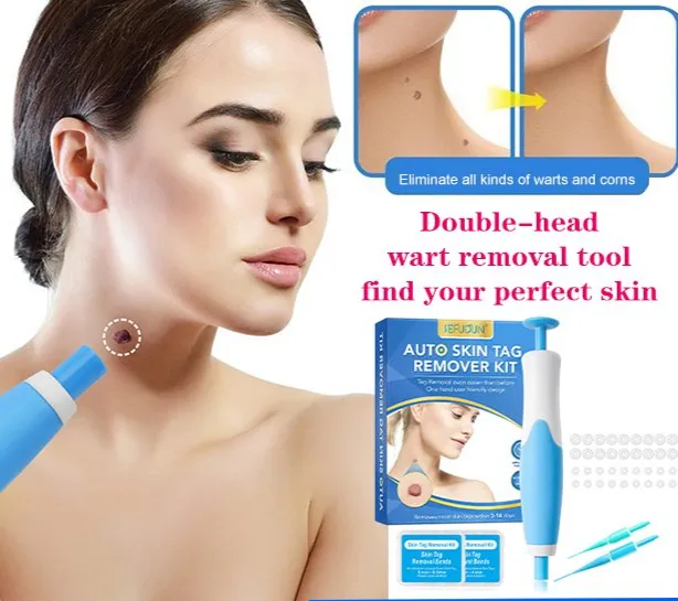 Doubleended skin tag remover tool kit for removing corns, warts, moles
