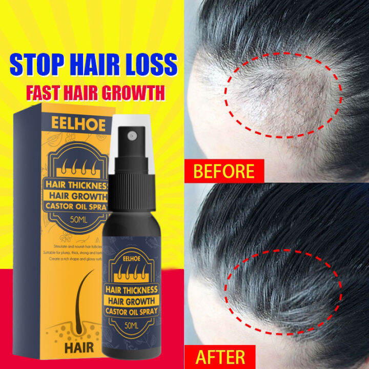 Castor Oil Hair Grower Spray Rapid Hair Growth Essence Anti Hair Loss ...