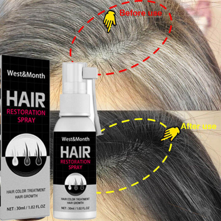 Polygonum Multiflorum Black Hair Sprayer Natural Extract Turn White