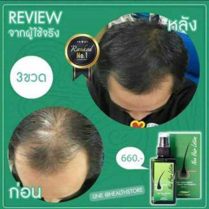 NEW NEO HAIR LOTION HAIR GROWTH SOLUTION ORIGINAL THAI PRODUCT MURAH