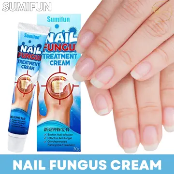 Tinedol cream - skin legs against nail fungus and smell ORIGINAL | eBay