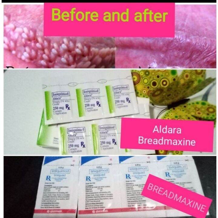 Aldara Imiquimod and Imiquad Imiquimod cream Sold per single sachet