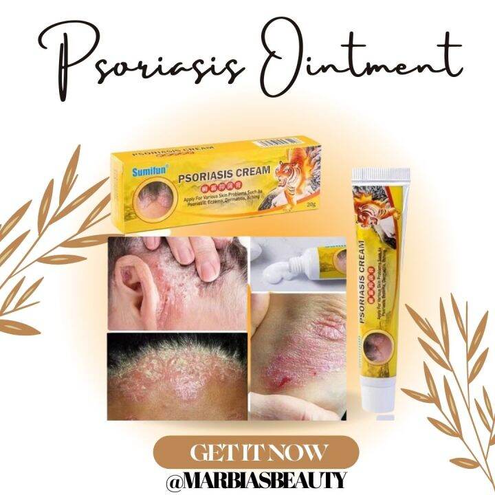 ORIGINAL!!!!! Psoriasis Ointment Dermatitis Eczema Tinea Itching ...