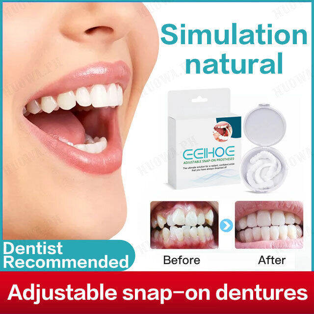 Ezey Gap Fillers Dentures Trimming Teeth Adjustable SnapOn Denture