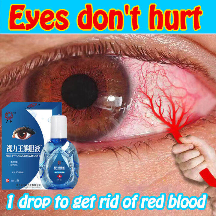 Eye Drops！Antifatigue 15ml, Eye Drops Eye Care Solution Clearing Heat