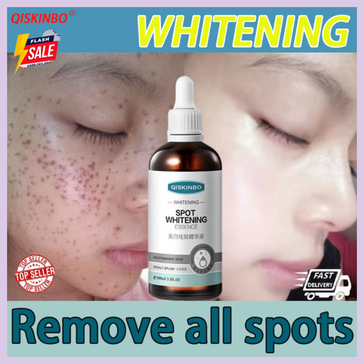 QISKINBO melasma and pekas remover serum, melasma removal cream ...