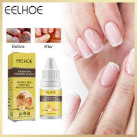 เอสเซรั่มดูแลเล็บ Eelhoe โสมรักษาเชื้อรามืออาชีพเซรั่มดูแลเล็บสีเทาส่วนผสมจากธรรมชาติ (10มล./กล่อง)