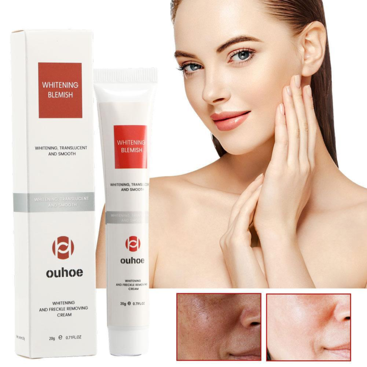 15. Get Rid of Acne Scars and Uneven Skin Tone with 20g Dark Spot