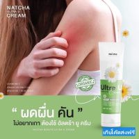 ของแท้ 100% Natcha Ultra U นัชชา อัลตร้ายู ครีม ลดปัญหาผิว (30 g) เก็บโค๊ดส่งฟรี