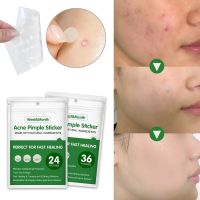 Natural Ingredient Acne Pimple Sticker Hydrocolloid Patch Acne Remover Treatment Blemish Spot SkinCare Beauty Tool Free Shipping