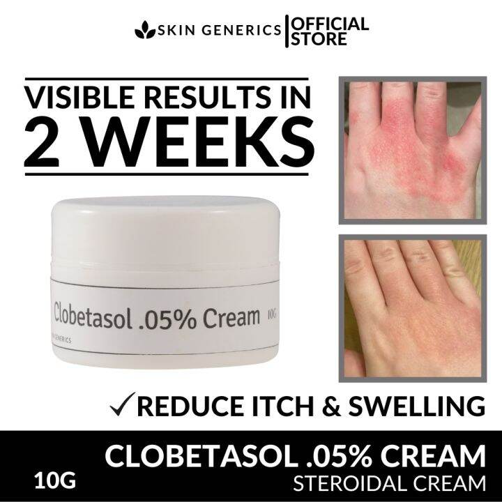 [ ANTI ITCH ANTI RASH ] SkinGenerics Clobetasol .05 AntiInflammatory