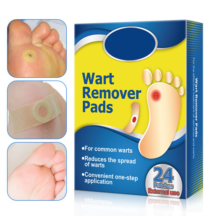 Wart Remover Wart Removal Plasters Pad Foot Warts Removal Anti-warts ...