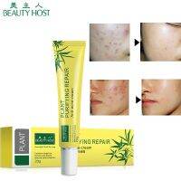 ?พร้อมส่ง?ของแท้ 100% Plant Purifying Repair - Anti-Acne Cream 20G แผลเป็น กำจัดสิว ครีมทาหน้า หน้าขาวใส แบบสาวเกาหลี บูสติ้ง ครีมผิวใส เร่งด่วน 1 หลอด