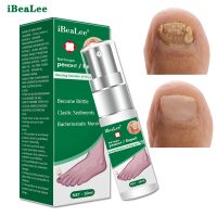 iBeaLee Nail Fungal Treatment Fungus Repair Essence Serum Paronychia Onychomycosis Anti Infection Care Foot Fungus Removal Gel