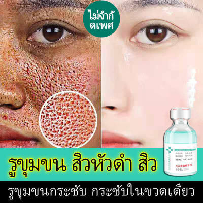 Pore Refining Serum รูขุมขนกระชับ Skin Care Essence Moisturizing Whitening Anti-aging Oil Control Facial Essenceเซรั่มไฮยา กระชับรูขุมขน เซรั่มกระชับรูขุมขน ให้ความชุ่มชื้นแก่ผิว เซรั่มรูขุมขน รูขุมขนกระชับขึ้ เอสเซนส์บำรุงผิวหน้า