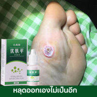 ลอกหูดตาปลา ติ่งเนื้อ เห็นผลทันทีเมื่อใช่ต่อเนื่อง Corns warts prickles calluses flat removal liquid เซรั่มแต้มหูด ลอกหูดตาปลา ปลอดภัยไม่เจ็บ