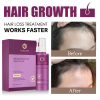 HAIRCUBE Hair Growth Essential Oils Anti Hair Loss Serum Damaged Hair Repair Beauty Dense Hair Growth Hair Care Products