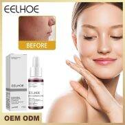 Diler beautyandhealth mịn lỗ chân lông khắc phục da khô chăm sóc da bghten
