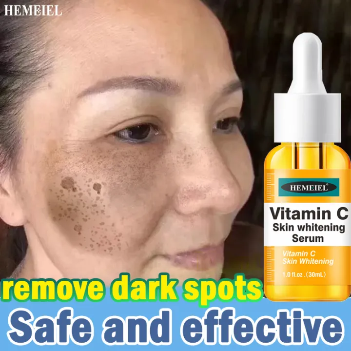 HEMEIEL vitamin c serum melasma and pekas remover original dark