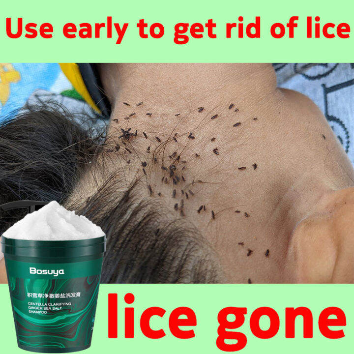 【Quick results in 5 minutes】lice removal shampoo for kids free shower cap grate comb anti lice