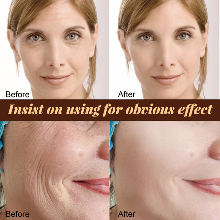 lntensive-moisturizing-brightening-skin-beauty-hydrating-skin-facial-anti-wrinkle-serum-สกินแคร์