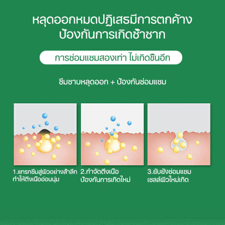 wart-removal-liquid-เอสเซ้นลอกหูด-10ml-ยาแต้มหูด-ลอกหูดตาปลา-ปลอดภัยไม่เจ็บตัว-ขจัดติ่งเนื้อ-เอสเซ้นลอกหูด-ไม่ทิ้งร่องรอยป-ครีมกําจัดไฝหูดติ่งเนื้อ