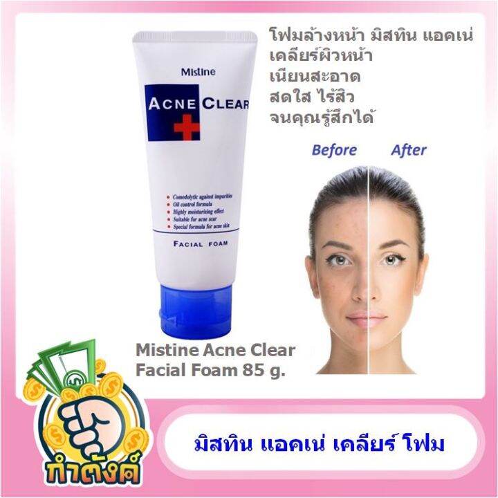 Mistine Acne Clear Facial Foam 85g. มิสทีน แอคเน่ เคลียร์ เฟเชี่ยล โฟม