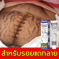 สำหรับรอยแตกลาย South Moon ครีมทาท้องลาย ต่อต้านริ้วรอย เหี่ยวย่น บางเบา สดชื่น ไม่เหนียวเหนอะหนะ (ลดรอยแตกลาย รอยแตกลาย ผิวลาย สะโพกลาย  ขาแตกลาย ครีมทาหลังคลอด  ครีมท้องแตกลาย)