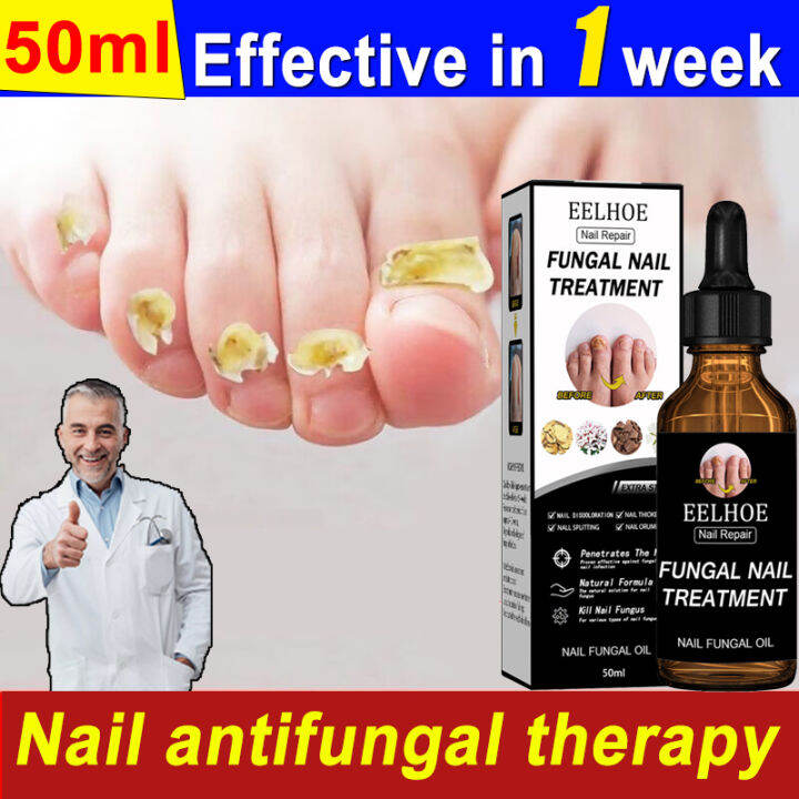 【EELHOE】 Nail Repair Treatment 50ml Nail Repair Serum Fungal Nail ...