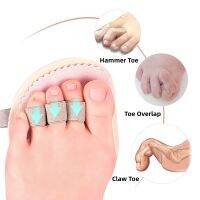 【CW】☾▫◆  1Piece Toe Protector Separator Support Temporary Corrector Bunion Guard Foot Spacers