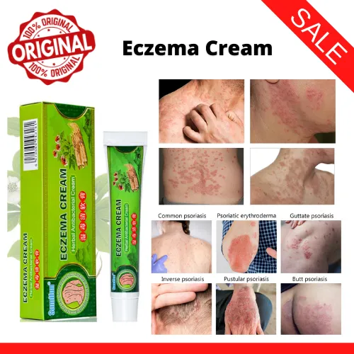 Eczema Treatment Cream gamot sa kati kati sa balat buni had had ...