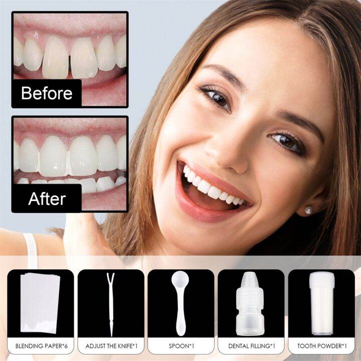 1 Tooth Filling Kit Temporary Dental Repair Cement Teeth Gap Falseteeth Solid Glue Fake Teeth