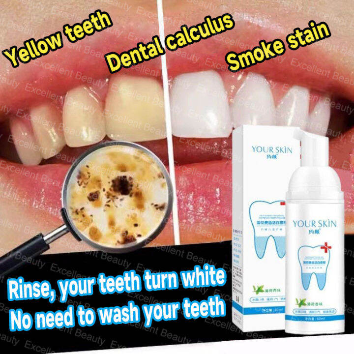 Teeth Whitening Mousse Toothpaste Oral Hygiene Remove Stains Plaque
