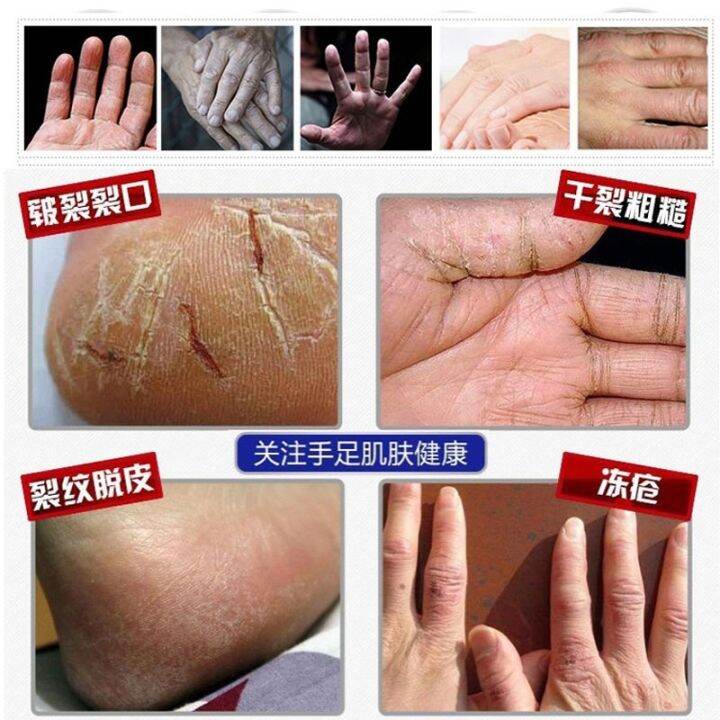 cw-traditional-chinese-33g-oil-anti-drying-crack-foot-cream-heel-cracked-repair-removal-dead-skin-hand-feet-care-mask