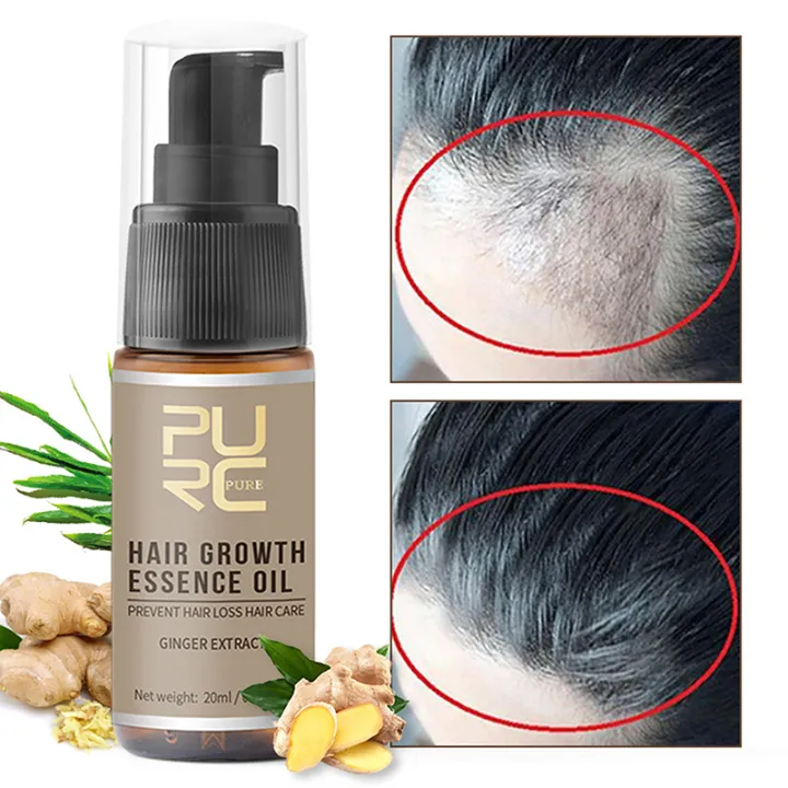 PURC New Hair Growth Spray Fast Grow Hair Oil Hair Loss Treatment ...