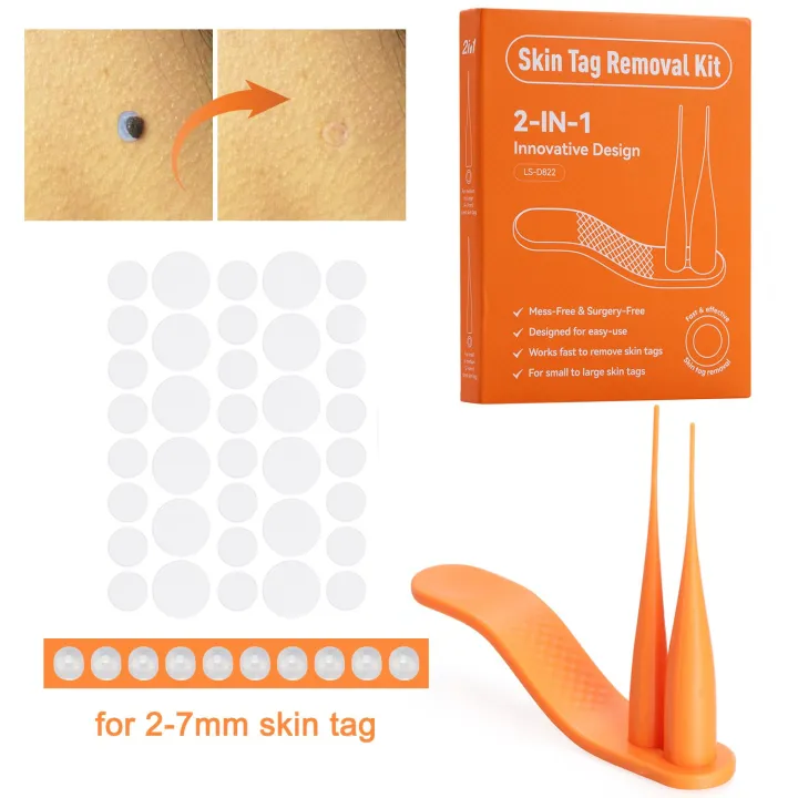 Skin Tag Removal Kit Rubber Bands WASTELAND BEAUTY NEW Beauty and Health Rubber Bands Mole Wart Tool Skin
