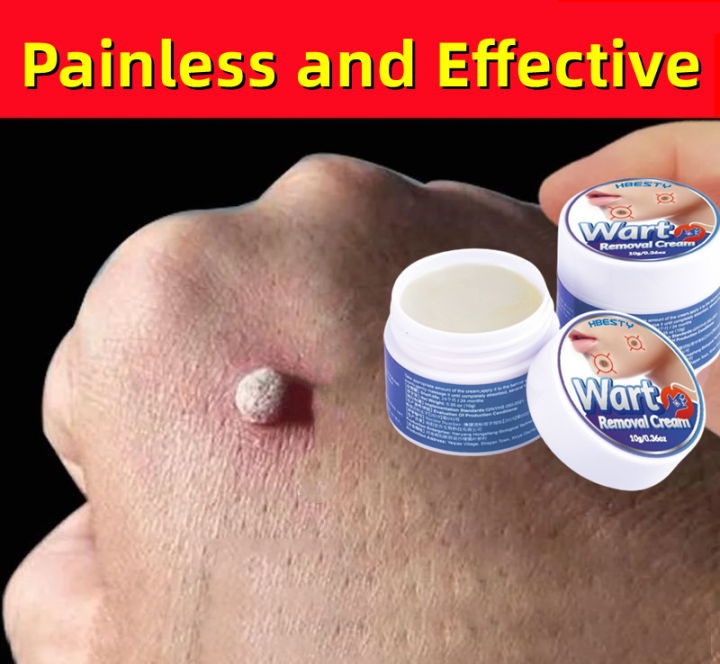 Wart Removal Cream Fast Remove Skin Tag Remover Original Ointment