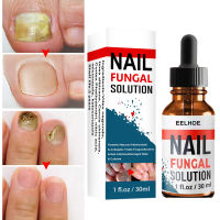 Eelhoe Nail Repairing Liquid Hand And Foot Onychomycosis Care Repair Onychomycosis Liquid Thickening Soft Nail