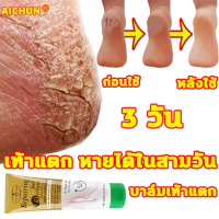 AICHUN ครีมส้นเท้าแตก 100ml เหมาะสำหรับส้นเท้าแตก ผิวแตก บำรุงผิว ครีมสันเท้าแตก ครีมทาเท้าขาว ครีมทาเท้า ครีมบำรุงเท้า ครีมทาเท้าขาว ครีมทาส้นเท้า ครีมทาส้นเท้าแตก ครีมทาส้นแตก ครีมเท้าขาว ครีมบำรุงส้นเท้า ดูแลเท้า foot cream