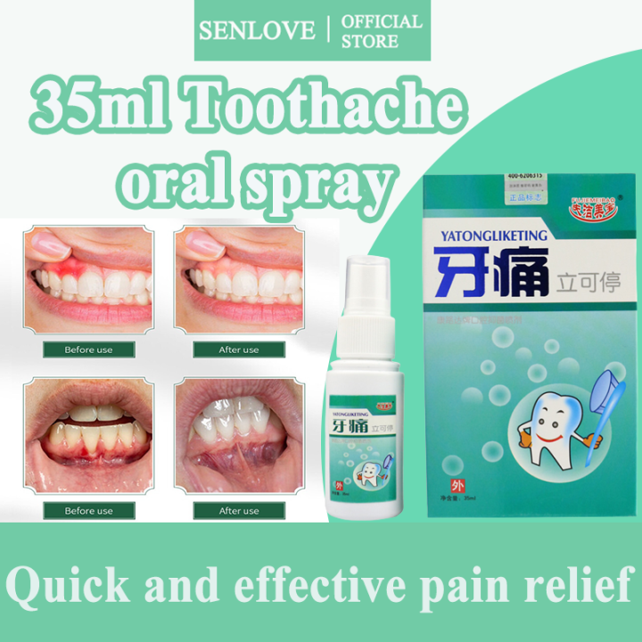 Senlove Toothache Insect Repellent Spray Toothache Spray Fast Pain Relief Plant Extracts Hormone