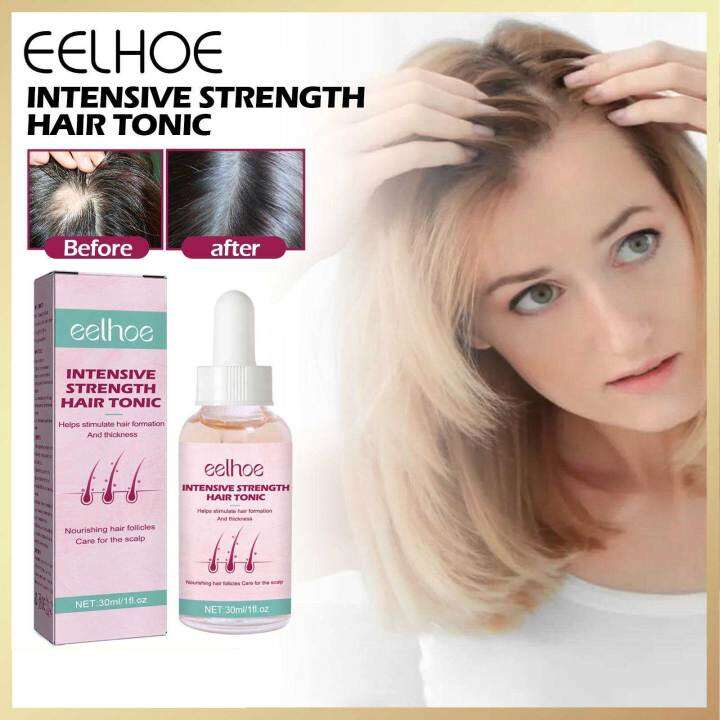 Eelhoe Hair Growth Oil Regrowth Anti Alopecia Baldness Thinning ...