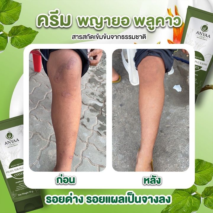 สบู่3ก้อน-300-พญายอพลูคาว-สบู่แก้คัน-เชื้อรา-กลากเกลื้อน-ของแท้จากบริษัท