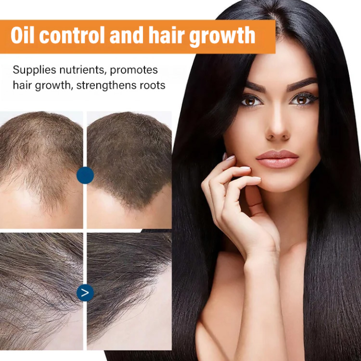 Cologo Hair growth essential oil repairs damaged hair, nourishes hair
