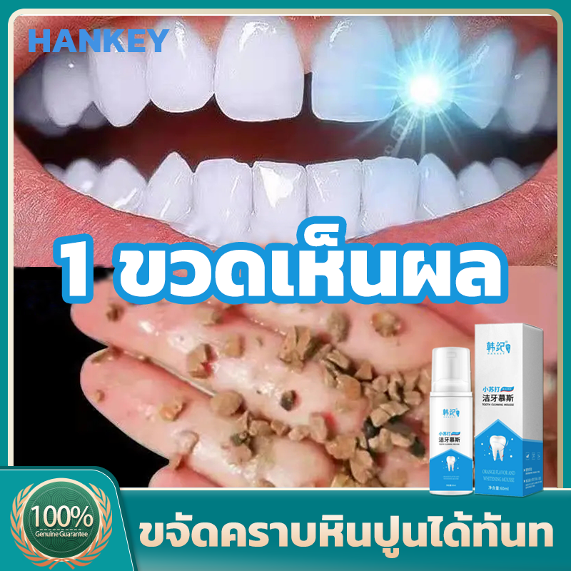 แนะนำ สูตรใหม่ ของแท้100%！HANKEY ยาสีฟันฟันขาว ขจัดคราบหินปูน ดับกลิ่นปาก แก้ฟันเหลือง  ลมหายใจสดชื่น （ยาสีฟันฟันขาว คราบฟัน บำรุงฟัน ฟันขาว ฟันเหลือง ยาสีฟันไวท์เทนนิ่ง คราบกาแฟ ยาสีฟันขจัดหิน เซรั่มฟอกฟันขาว ยาสีฟันฟอกขาว  น้ำยาฟอกสีฟัน ขัดฟันขาว）