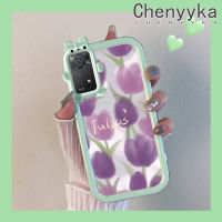 เคส Chenyyyka สำหรับ Xiaomi Redmi Note 11 Pro Note 5G 11e Note Pro เคสสีม่วง Tulip เคสรูปโบว์มอนสเตอร์น้อยเคสนิ่มทนต่อการขัดถูเคสโทรศัพท์โปร่งใสฝาครอบป้องกันเลนส์กล้องถ่ายรูป TPU ซิลิกาเจล