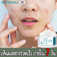 HEMEIEL รอยสิว/เซรั่มลดสิว/ครีมทาสิว