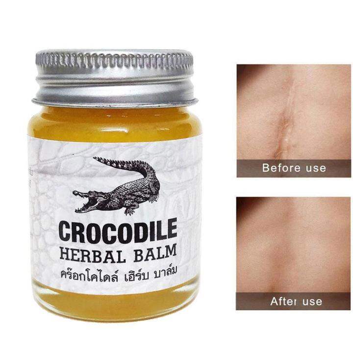Crocodile Scar Removal Cream Thailand Herbal Balm Whitening Remover